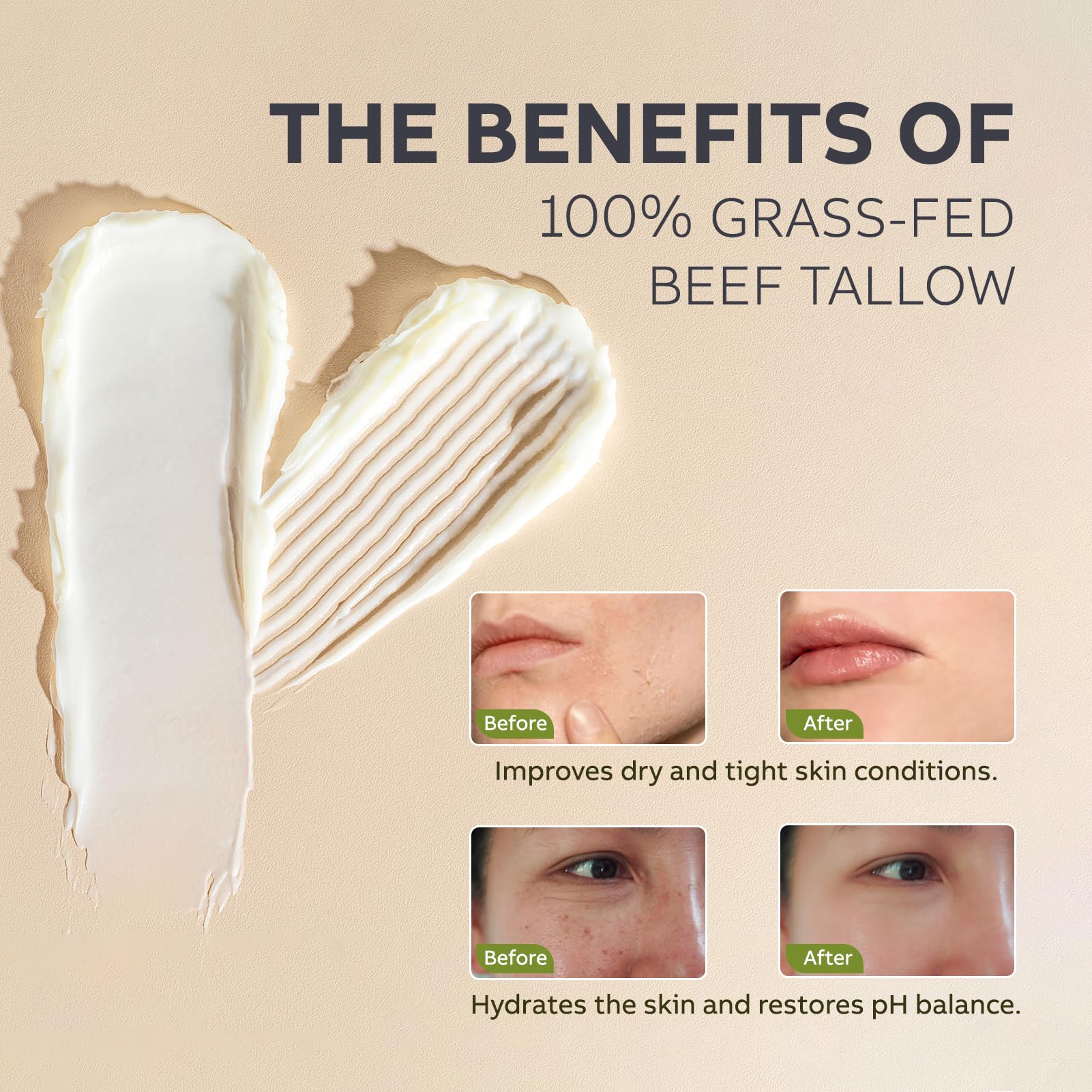 Beef Tallow and Honey Balm for Skin: Whipped Grass Fed Beef Tallow Balm Moisturizer with Raw Honey and Olive Oil for Face and Body - Natural Cow Fat Cream Unscented 🍁 All In One Marketplace Canada