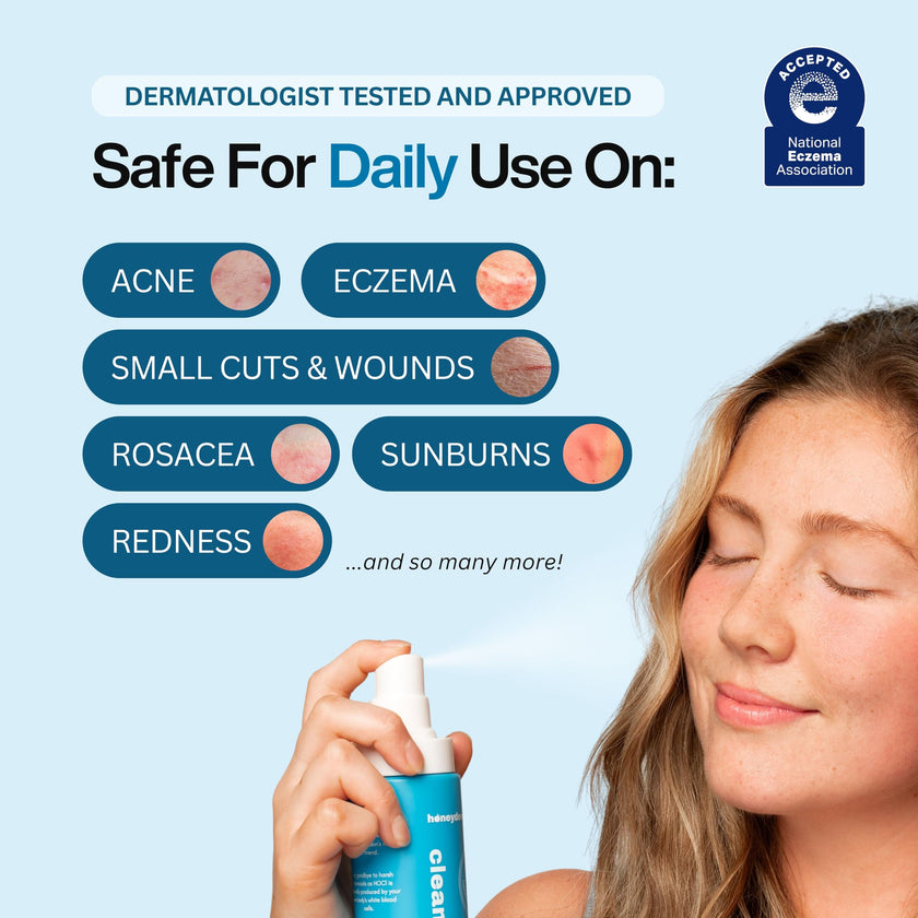 Hypochlorous Acid Spray – Dermatologist Tested HOCl Facial Cleanser for Sensitive, Acne-Prone & Irritated Skin – Soothes Redness, Eczema, Rashes & Itching – Skin Repair Spray, 200 mL - Honeydew Labs 🍁 All In One Marketplace Canada