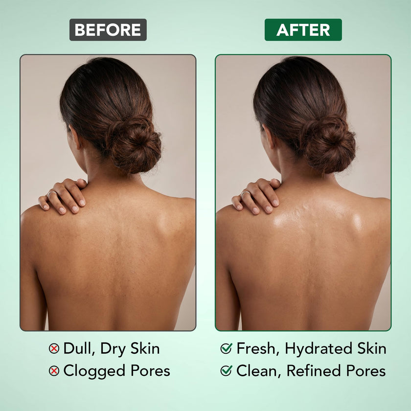 Botanic Hearth Eucalyptus Tea Tree Body Wash | Shower Gel - 16 fl oz | for Men and Women | Antifungal, Moisturizing & Soothing Formula with Natural Oils 🍁 All In One Marketplace Canada