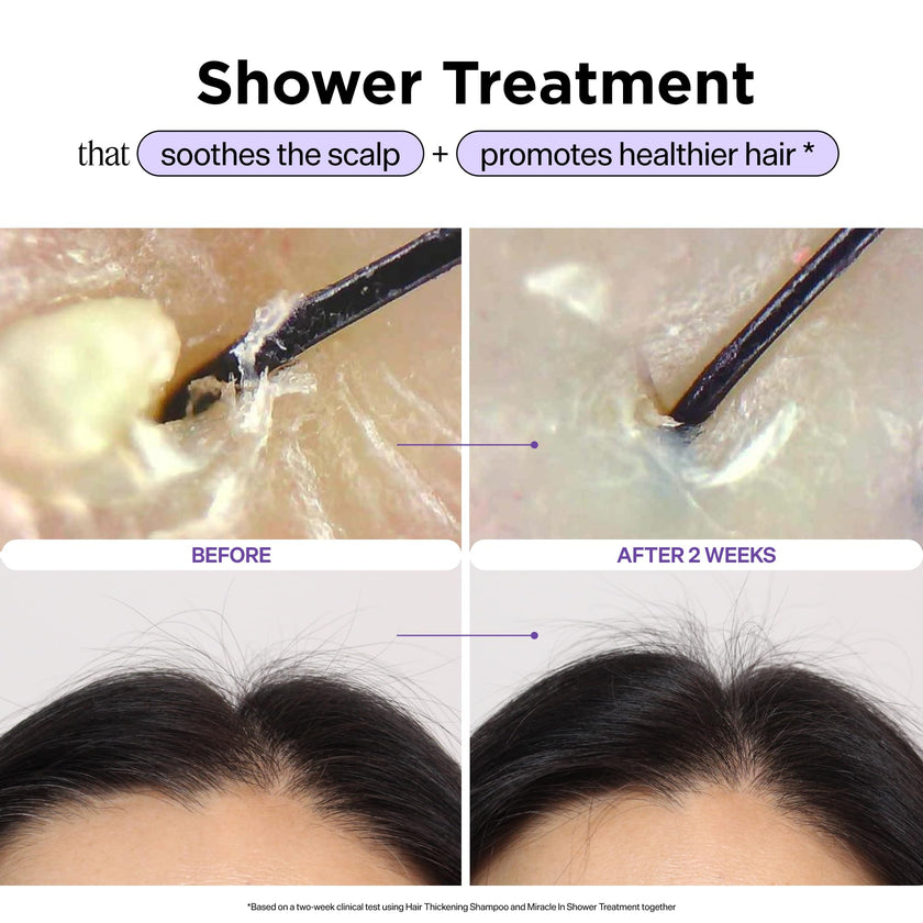 Dr. Groot Miracle in Shower Treatment, Korean Hair Care, 5 Seconds to Smooth Hair, Rosemary Oil for Healthier-Looking Hair, Hair Rinse, Moisturizing Treatment, Scalp Revitalizing Solution 🍁 All In One Marketplace Canada