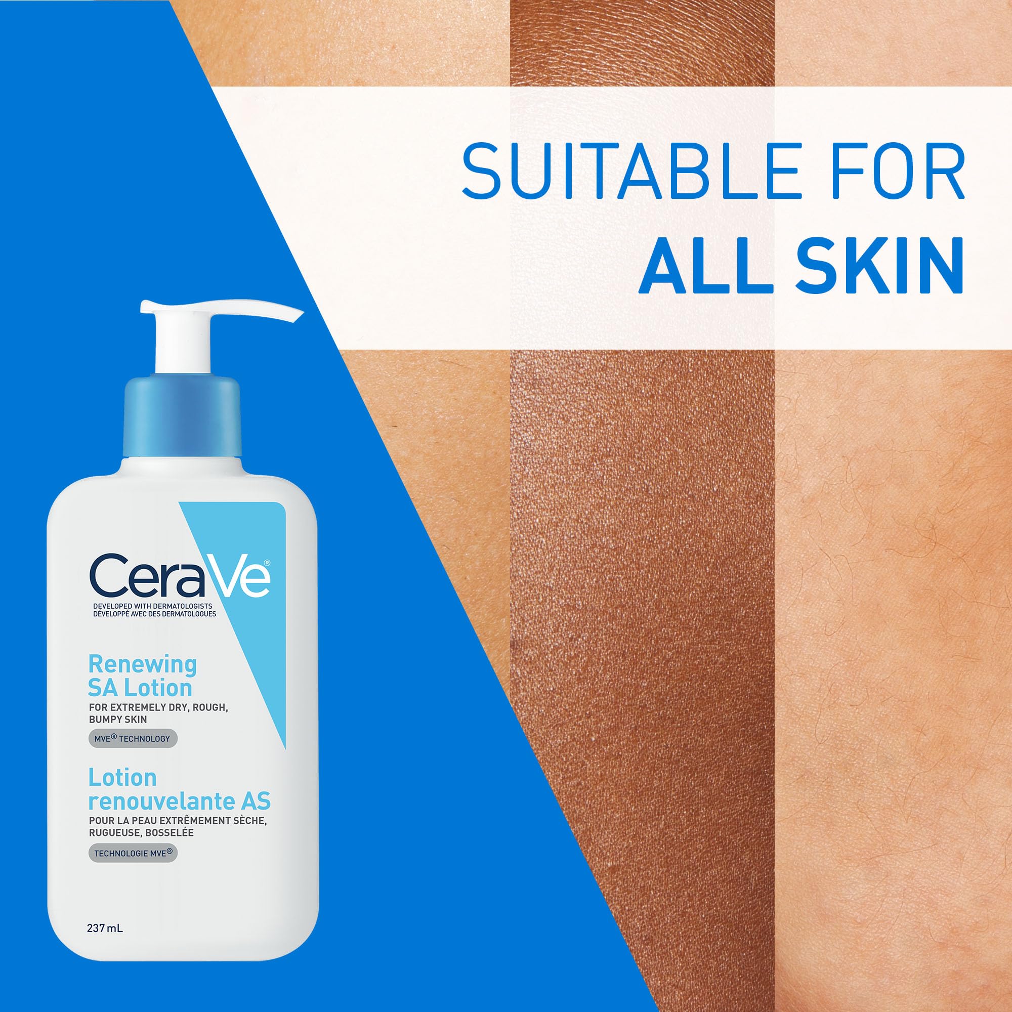 CeraVe SALICYLIC ACID Lotion, Renewing SA Exfoliating Body Lotion for Dry, Rough & Bumpy Skin, Psoriasis, Keratosis Pilaris, Itching & Flaking. With Lactic Acid, Hyaluronic Acid, Fragrance Free, 237ML 🍁 All In One Marketplace Canada