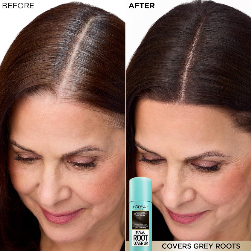 L'Oréal Paris Magic Root Cover Up Root Touch Up, Dark Brown Hair Dye, Root Touch Up Spray for Thinning Hair, Temporary Hair Dye, Grey Coverage, Pack of 2 🍁 All In One Marketplace Canada