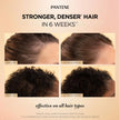 Pantene Abundant & Strong Daily Scalp Serum, Strengthens Scalp’s Hold on Roots, 60 ml 🍁 All In One Marketplace Canada