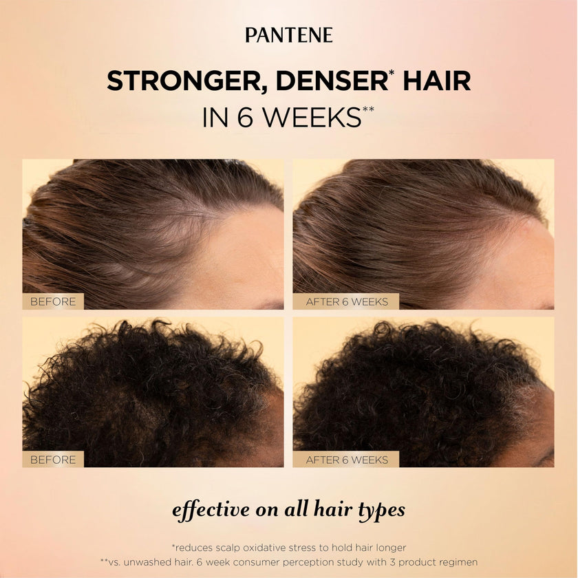 Pantene Abundant & Strong 3-Step System, Shampoo (400 ml), Conditioner (236 ml), Serum (60 ml), Strengthens at the Root, 3 Count 🍁 All In One Marketplace Canada