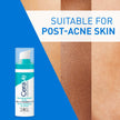 CeraVe Resurfacing Retinol Serum For Face with Niacinamide. Helps even Skin Tone & Smoothness, Post-Acne Marks & Pore Minimizer. Gentle, Fragrance-free, Non-Comedogenic, Safe for Sensitive Skin, 30ML 🍁 All In One Marketplace Canada