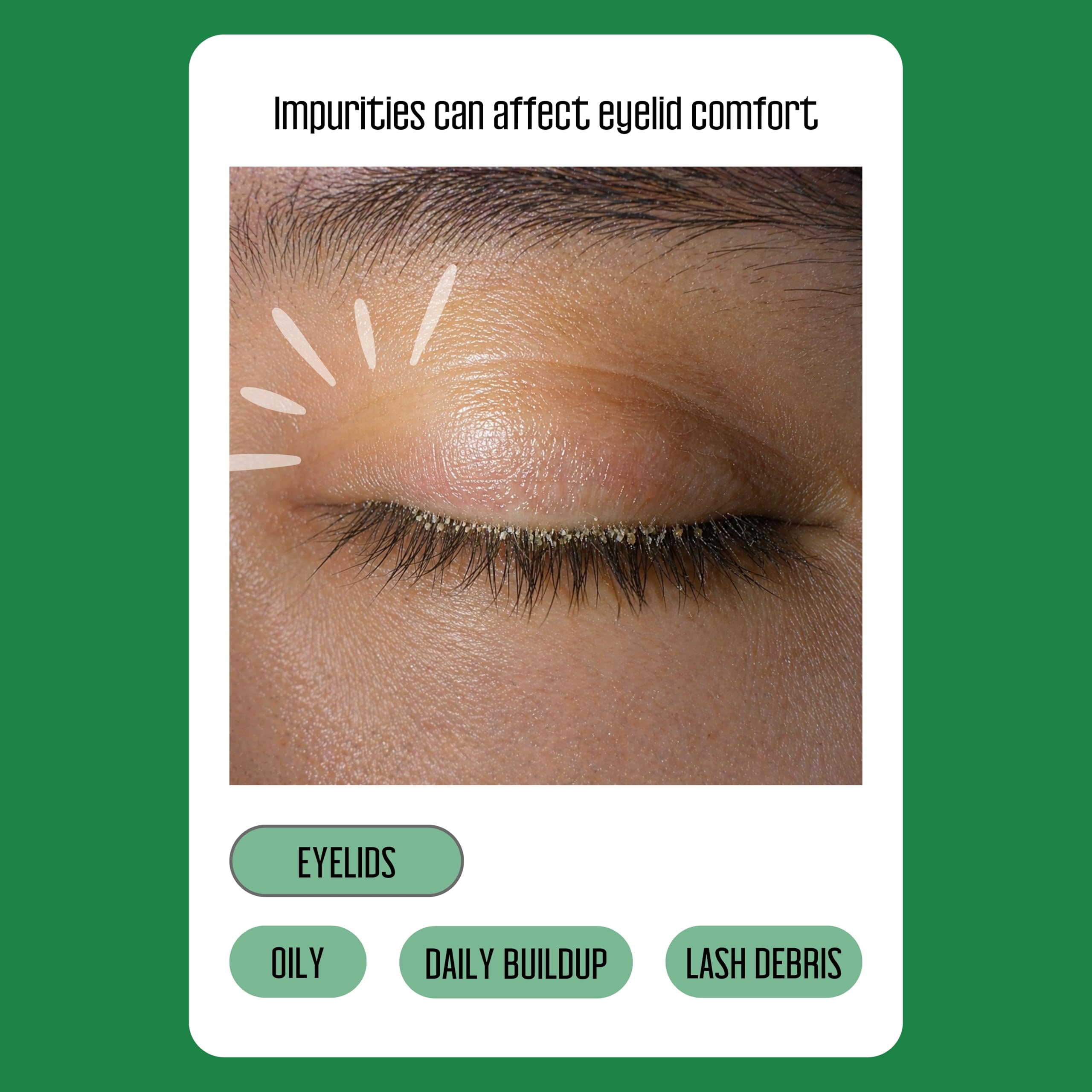 Tea Tree Eyelid Wipes – 100 Tea Tree Oil Eye Wipes for People with Dry Eyes & Allergies – Gentle Eyelid Cleanser with Hyaluronic Acid – Individually Wrapped & Biodegradable 🍁 All In One Marketplace Canada