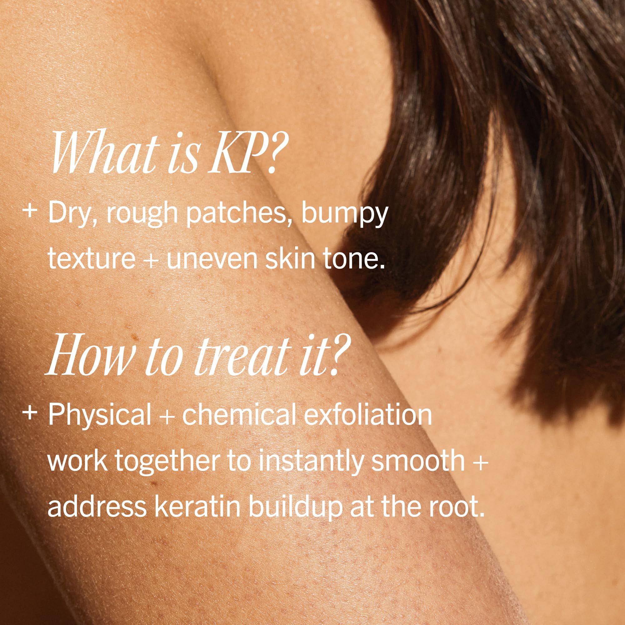 First Aid Beauty KP Bump Eraser Body Scrub, 10% AHA Keratosis Pilaris Exfoliator - Glycolic & Lactic Acid with Pumice, Treatment for Strawberry Legs, Razor Bumps & Rough Bumpy Skin, Safe for Sensitive Skin, 10 oz, Unscented 🍁 All In One Marketplace Canada