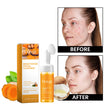 Hoygi Turmeric Brightening Facial Cleanser with Brush – Rose Water, Kojic Acid, 100ml