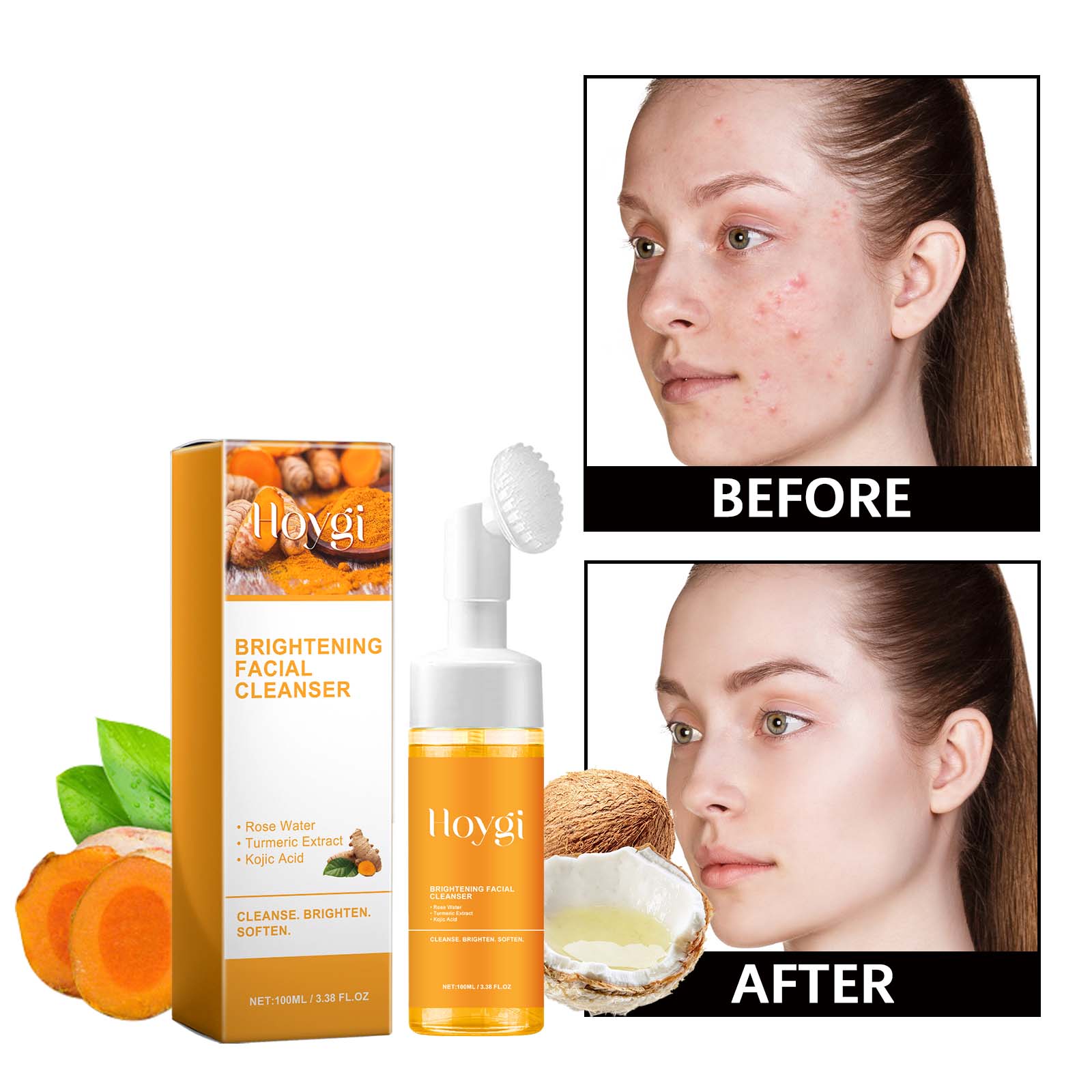 Hoygi Turmeric Brightening Facial Cleanser with Brush – Rose Water, Kojic Acid, 100ml