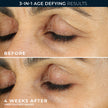 RoC Retinol Correxion Under Eye Cream for Dark Circles & Puffiness, Daily Wrinkle Cream, Anti Aging Line Smoothing Skin Care Treatment for Women and Men, with Retinol Eye Cream Packette 🍁 All In One Marketplace Canada