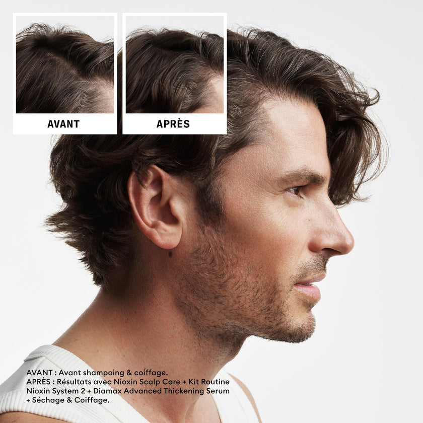 Nioxin Scalp + Hair Thickening System 2 Shampoo, For Natural Hair with Progressed Thinning, 33.8 fl oz (Packaging May Vary) 🍁 All In One Marketplace Canada