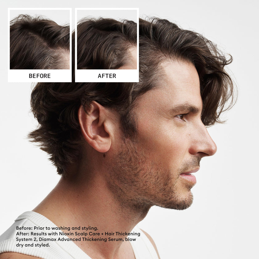 Nioxin Scalp + Hair Thickening System 2 - Hair Thickening System for Natural Hair with Progressed Thinning, Full Size (Packaging May Vary) 🍁 All In One Marketplace Canada