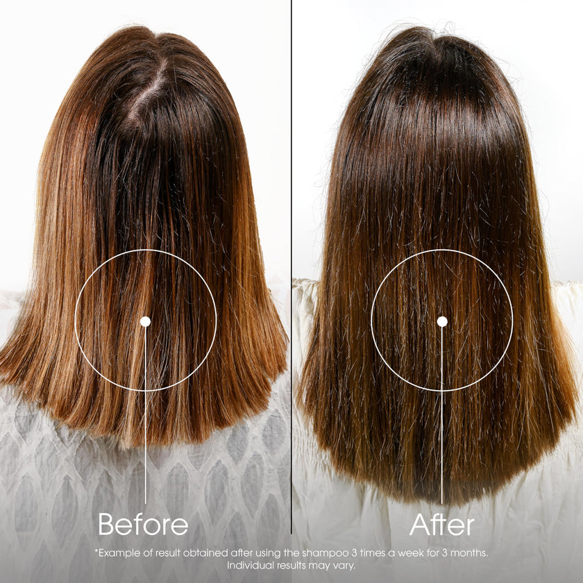 Klorane quinine fortifying shampoo for thin, tired hair, 400ml 🍁 All In One Marketplace Canada