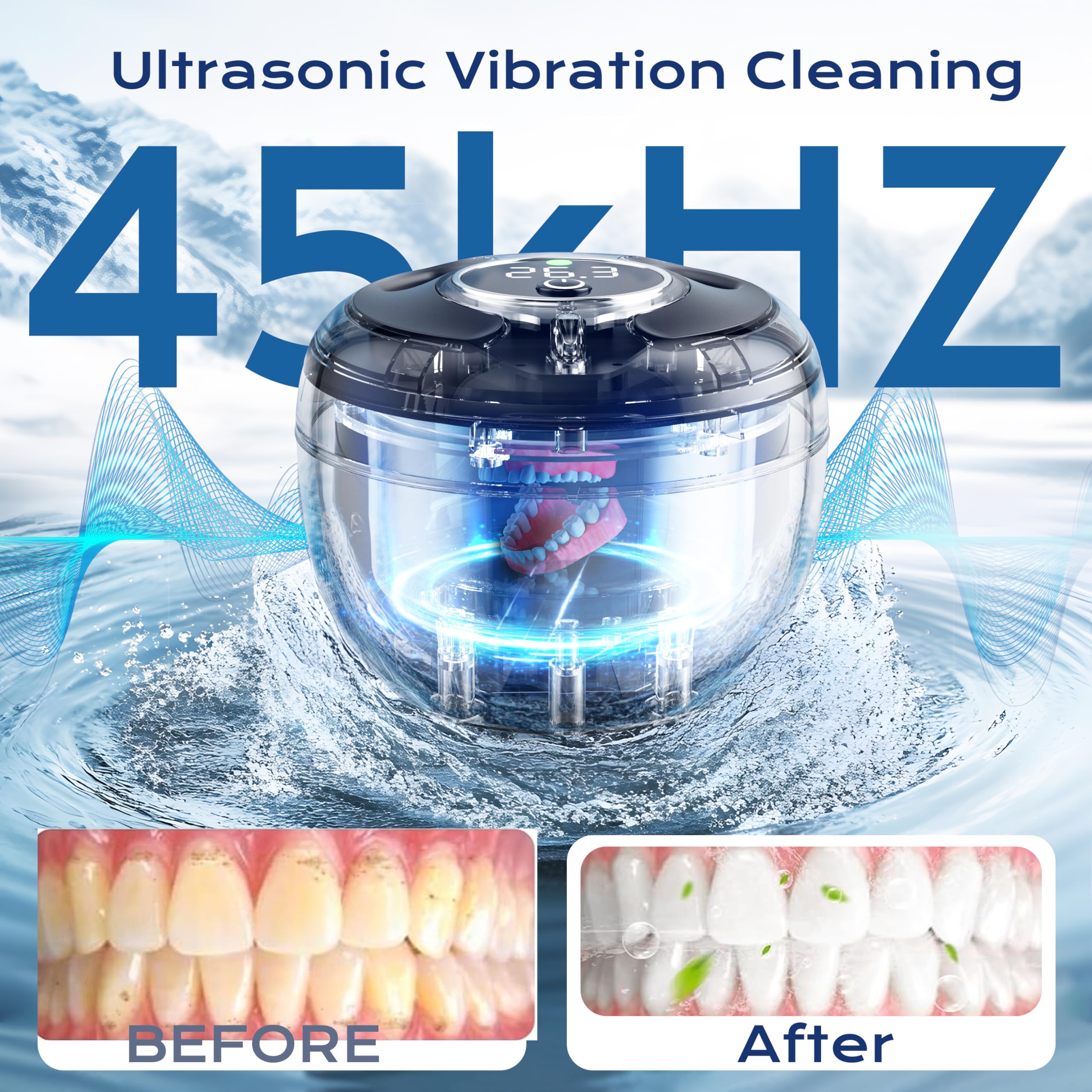 Ultrasonic Retainer Cleaner(2026 Upgraded), 45kHz Cleaning Machine for Dentures, Mouth Guards, Braces, Toothbrush & Jewelry, 200ML Denture Cleaner with 4 Modes for Denture Appliances 🍁 All In One Marketplace Canada