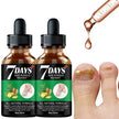 7DAYS Nail Fungus Treatment Serum Care Hand And Foot Care Removal