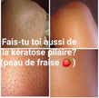 Rejuveniqe