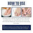 Relieving And Repairing Ingrown Nail Toe Nail Removing Meat Treatment Oil