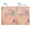 SkinCeuticals A.G.E. Advanced Eye
