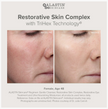 Alastin Restorative Skin Complex with TriHex Technology™