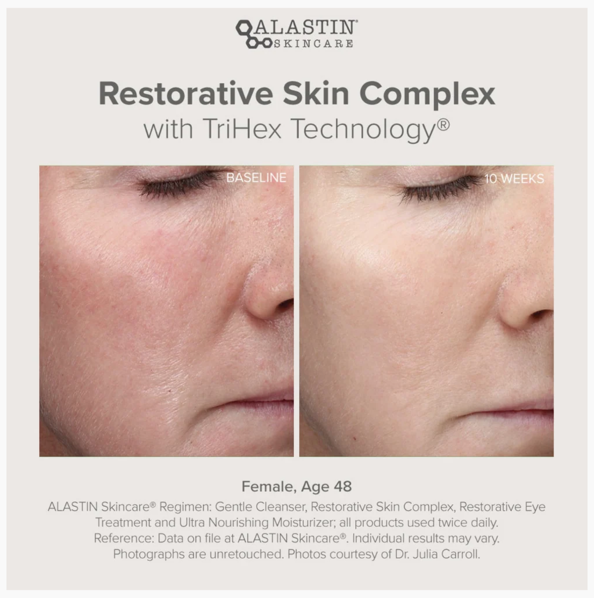 Alastin Restorative Skin Complex with TriHex Technology™