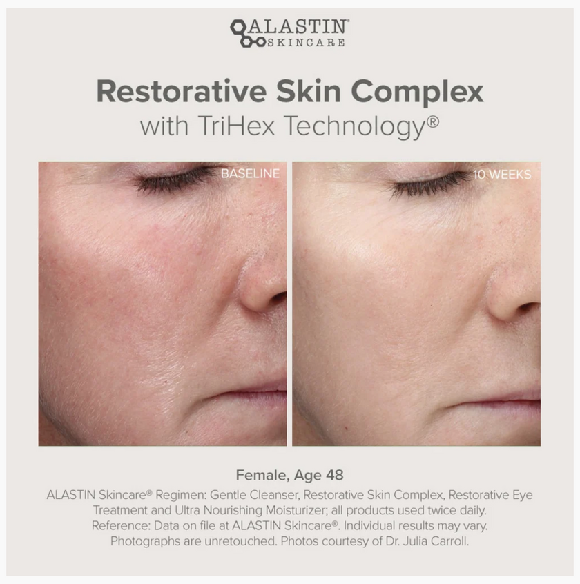 Alastin Restorative Skin Complex with TriHex Technology™