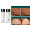AnteAGE MD Biosome System Serum + Accelerator