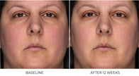 ZO Skin Health Recovery Crème