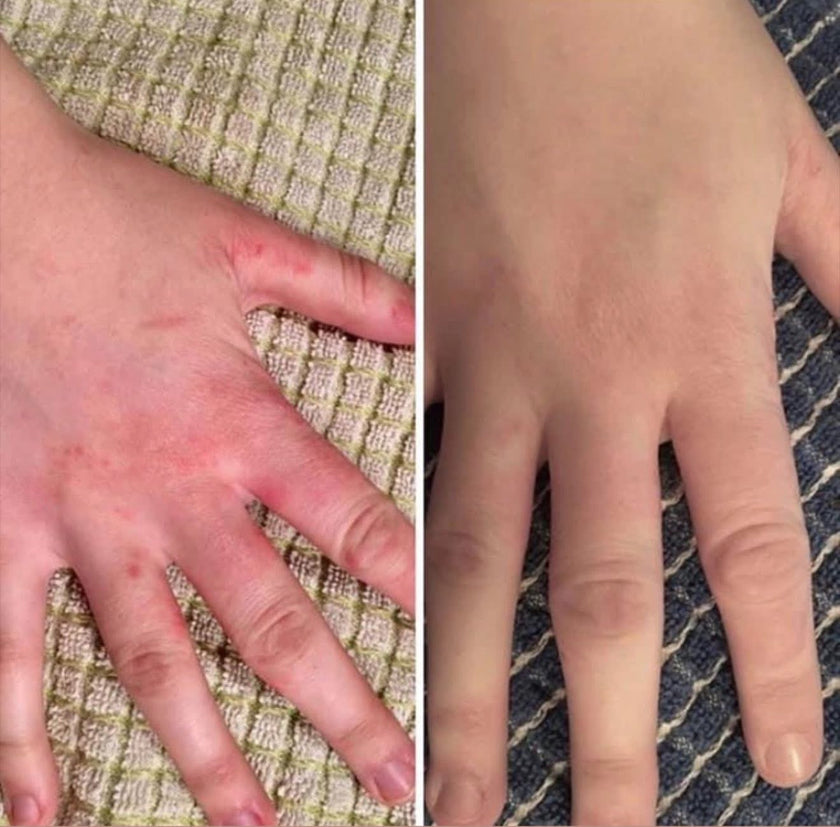 Rejuveniqe