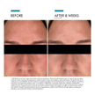 SkinCeuticals Clear Daily Soothing UV Defense Sunscreen SPF 50