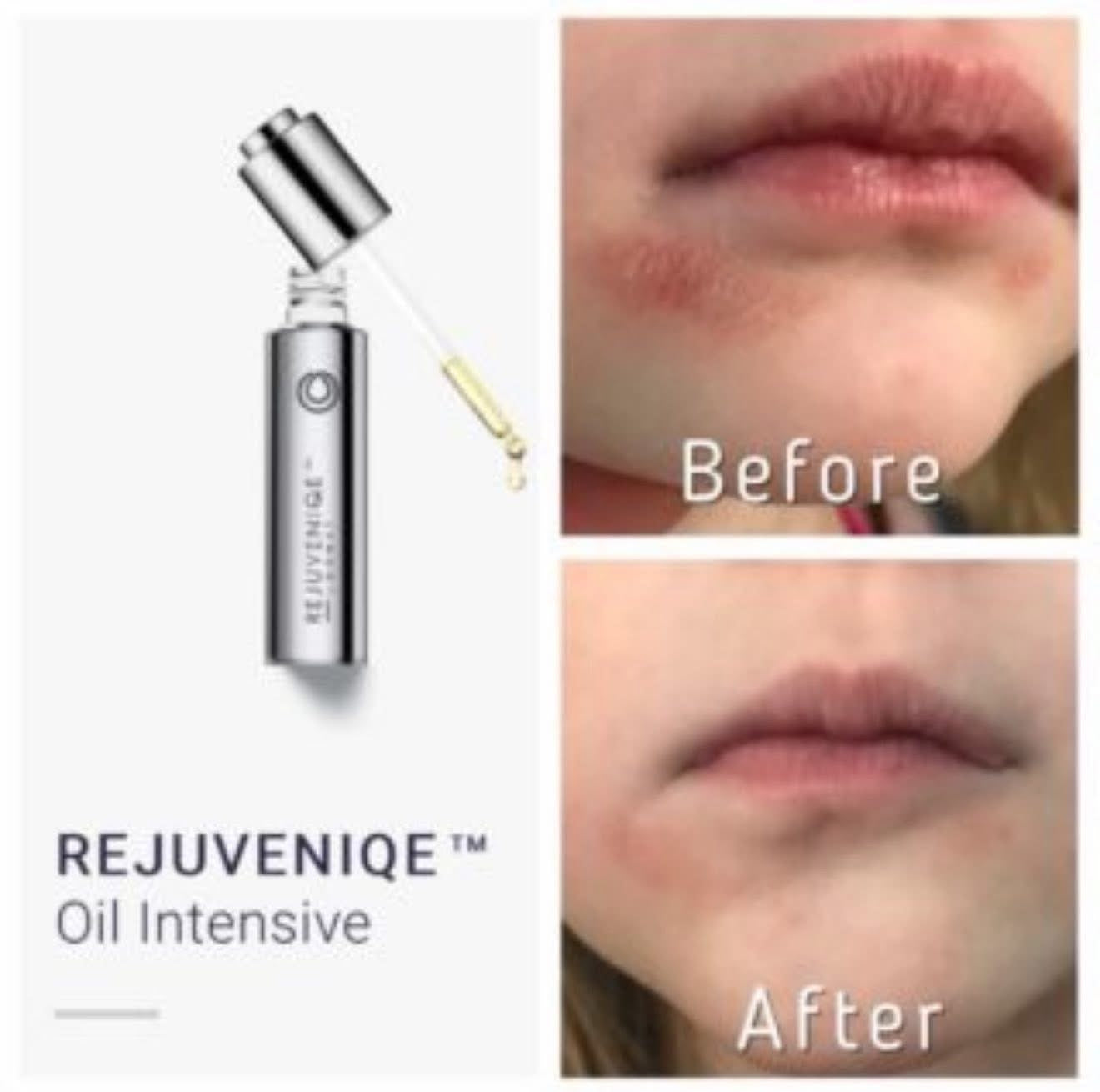 Rejuveniqe