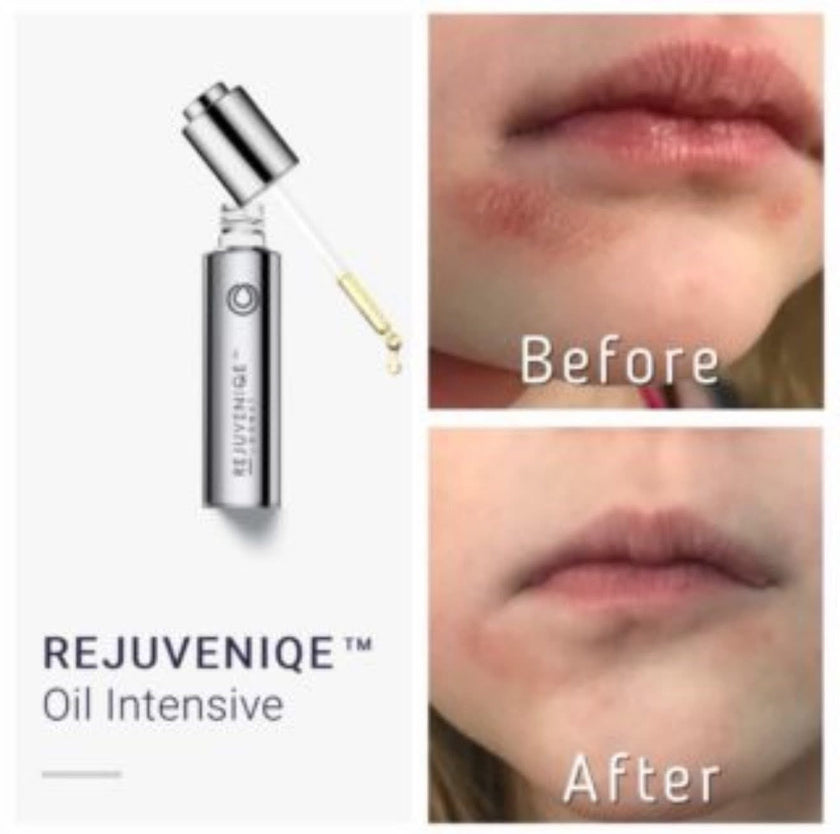 Rejuveniqe