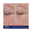 Obagi ELASTIderm® Advanced Filler Concentrate