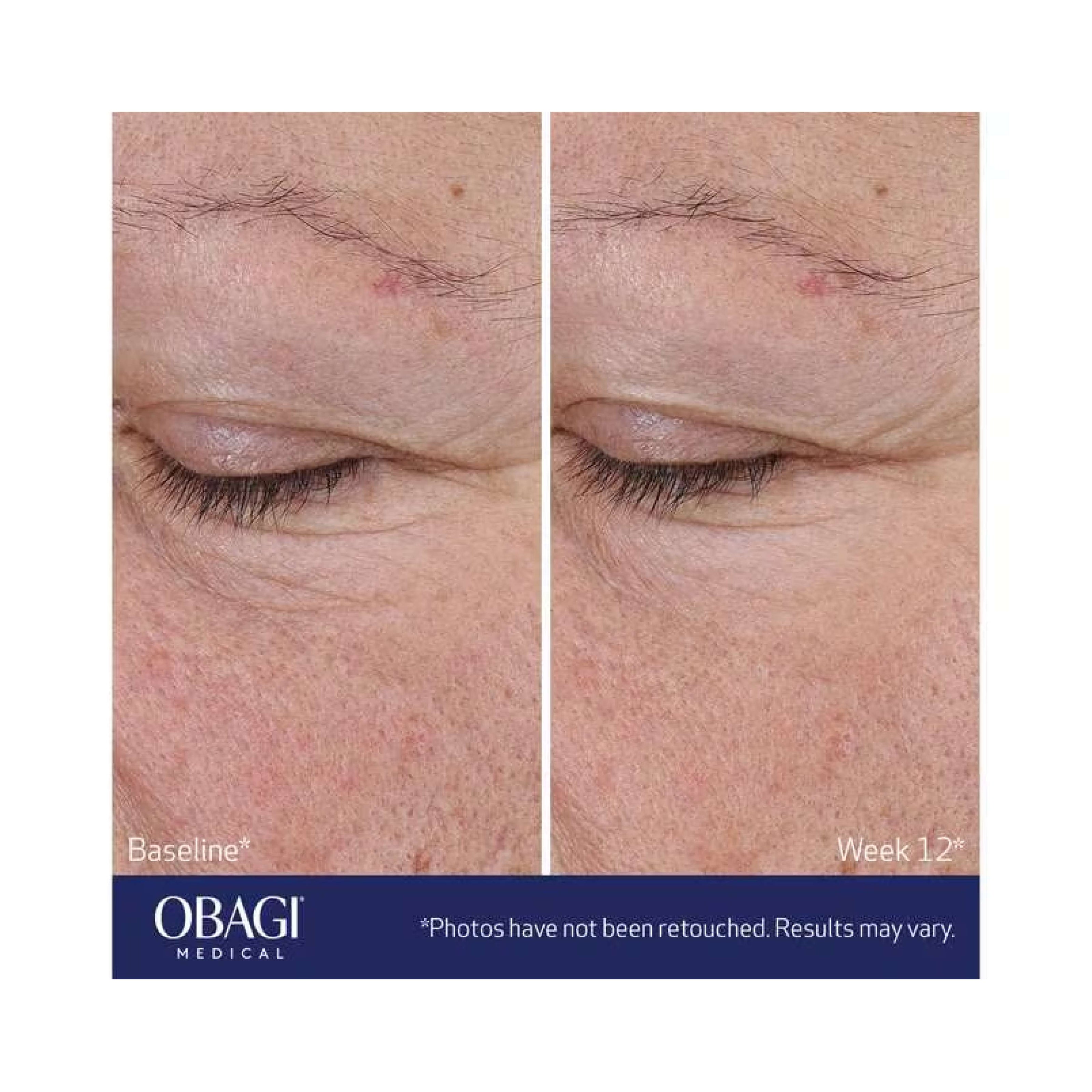 Obagi ELASTIderm® Advanced Filler Concentrate