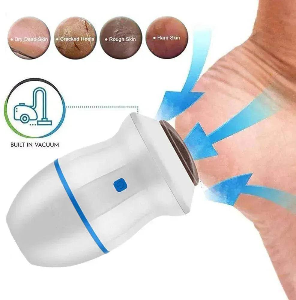 Exfoliate Dead Skin Callus Remover Heel Electric Vacuum Foot Grinder File Machine