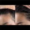 FOREO FAQ 301 LED Hair Strengthening Scalp Massager