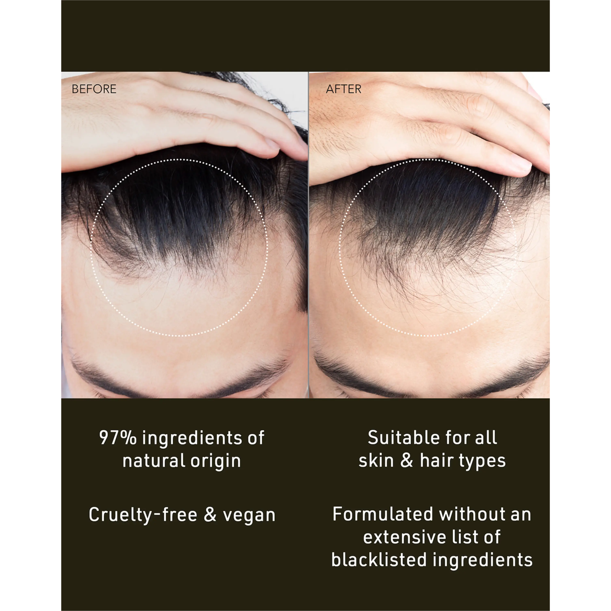 FOREO FAQ Scalp Recovery & Thick Hair Probiotic Serum