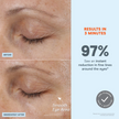 NuFACE FIX MicroWand