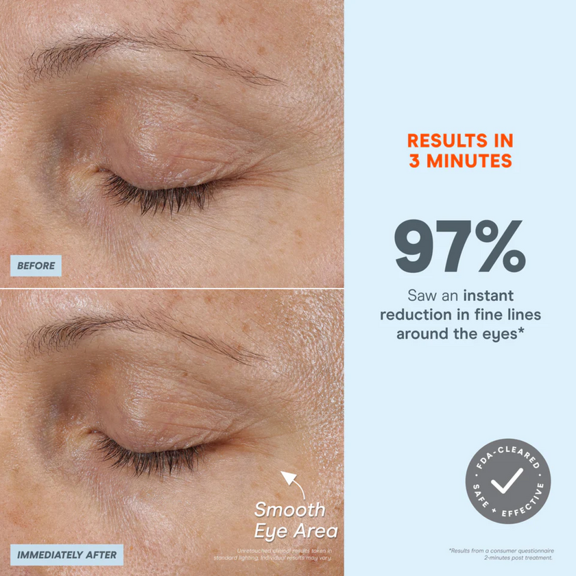 NuFACE FIX MicroWand