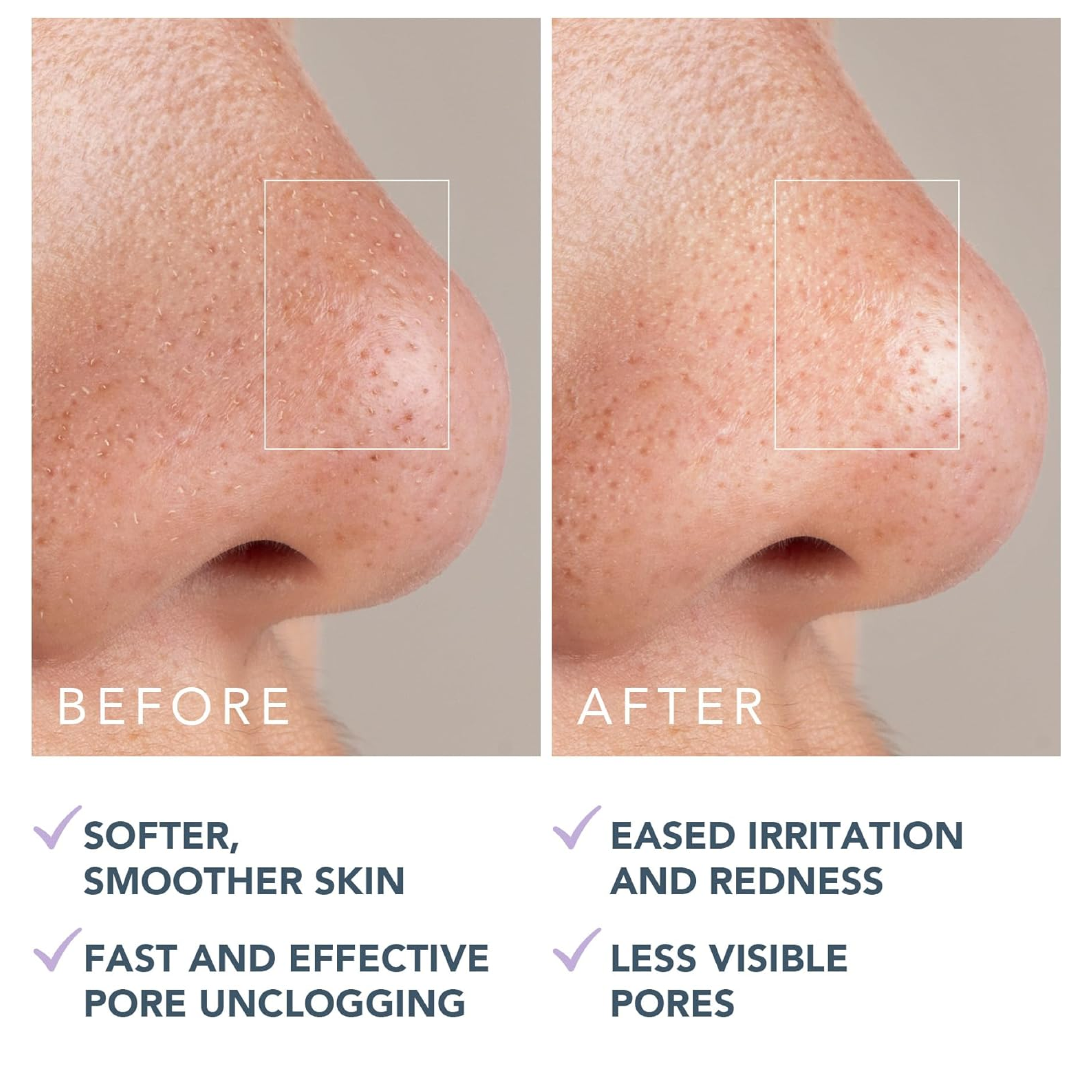 FOREO KIWI Active Pore & Blackhead Mask
