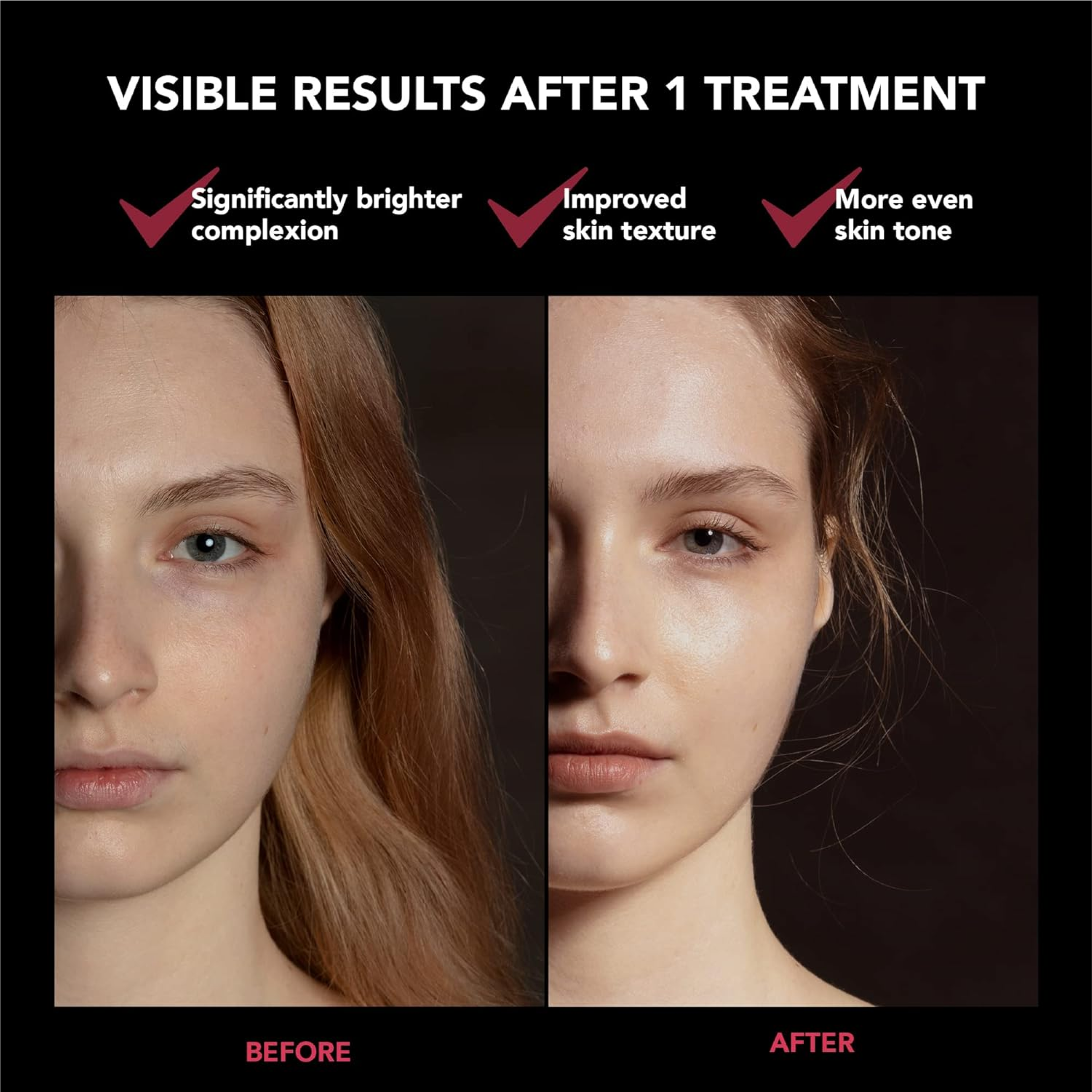 FOREO FAQ 201 Red Light Therapy LED Face Mask