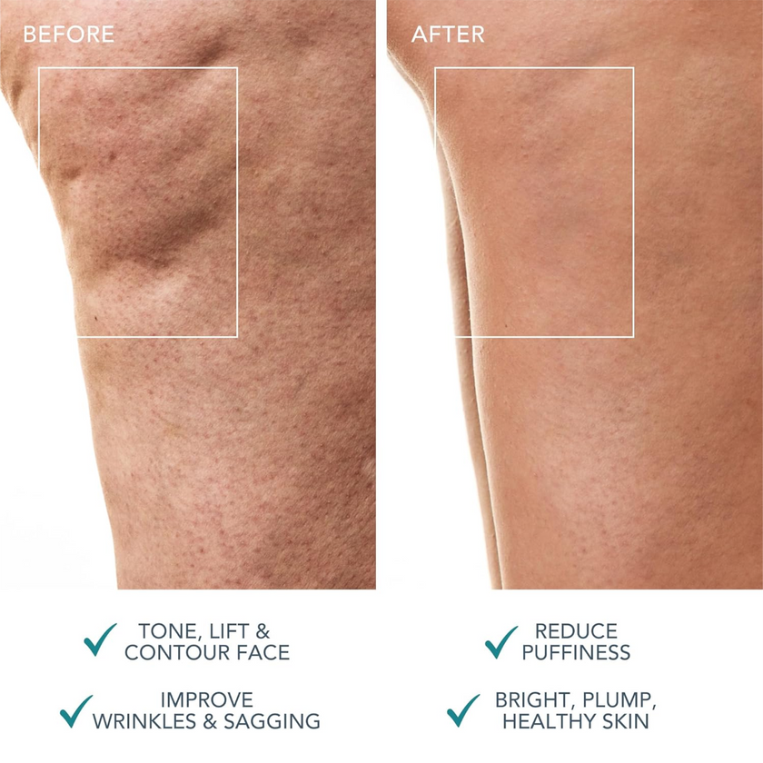 FOREO BEAR 2 Body - Evergreen