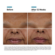 SkinCeuticals H.A. Intensifier Multi-Glycan