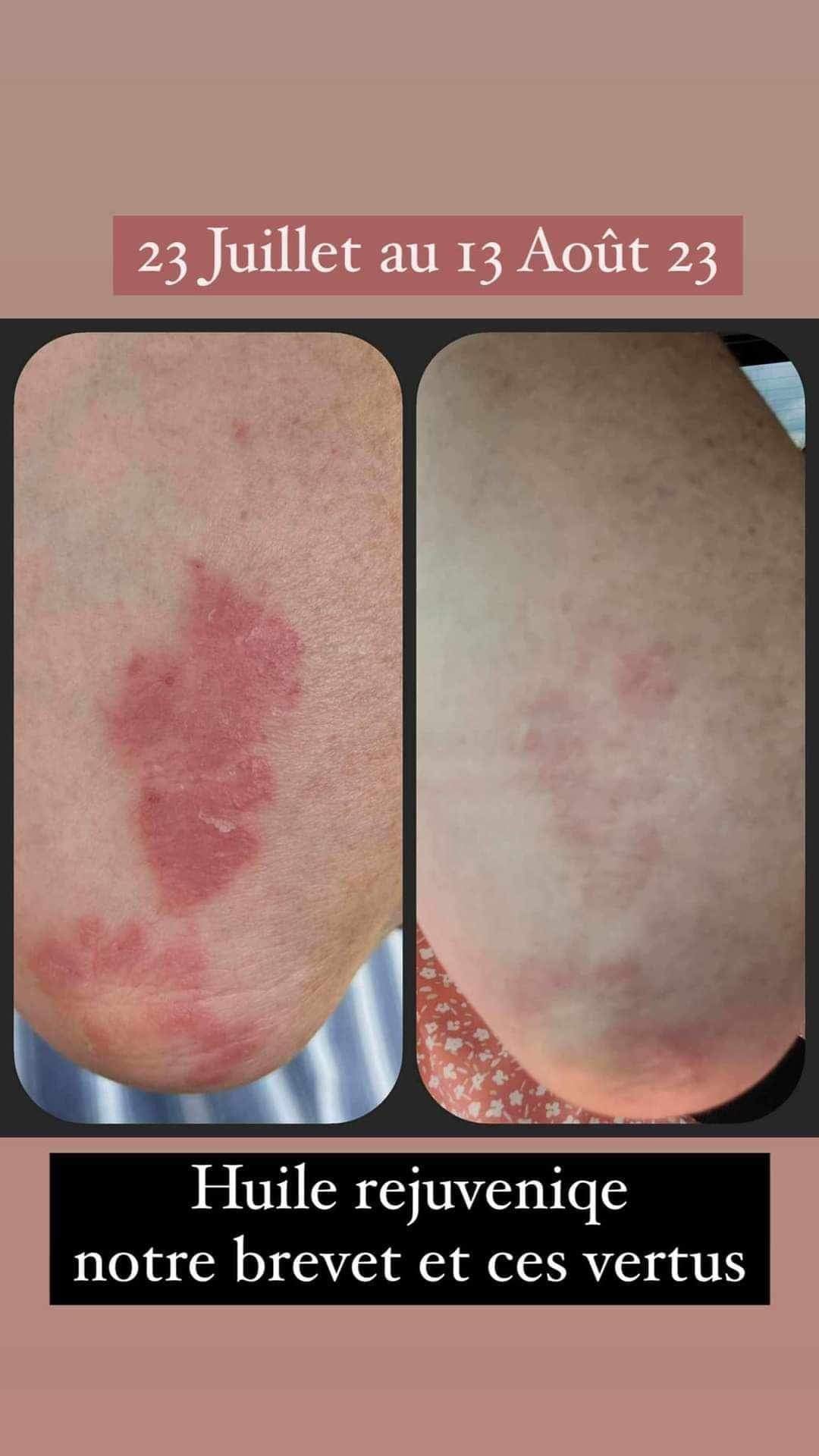 Rejuveniqe