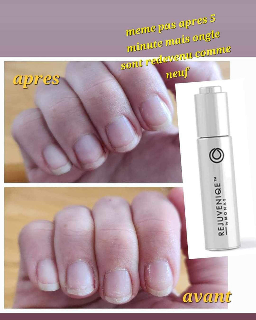 Rejuveniqe