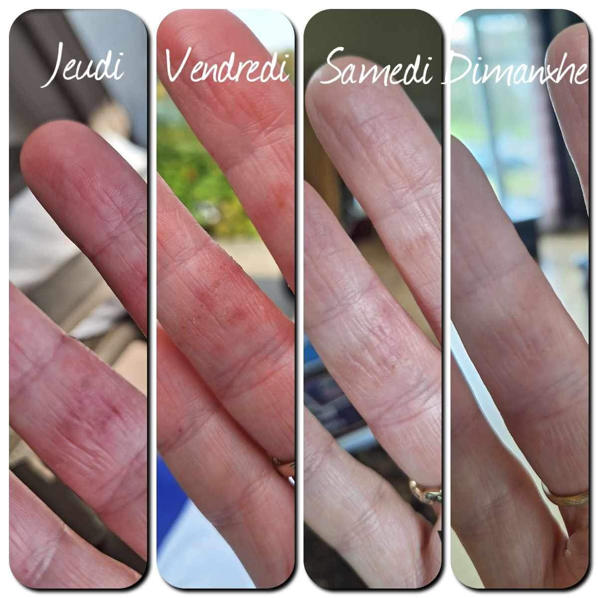 Rejuveniqe