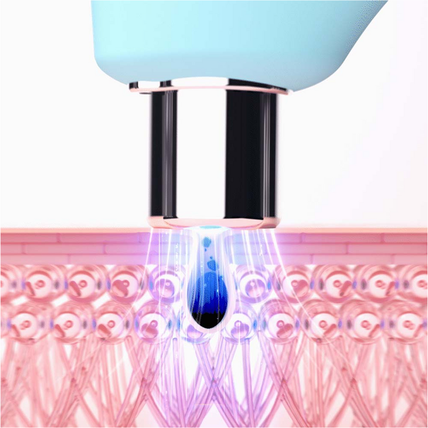 FOREO KIWI Blackhead Remover Pore Vacuum with Blue LED Light - Arctic Blue