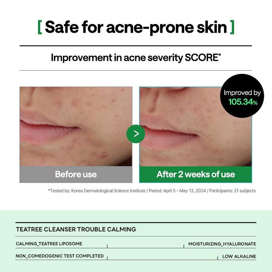 Mediheal Teatree Cleanser_Trouble Calming 120ml