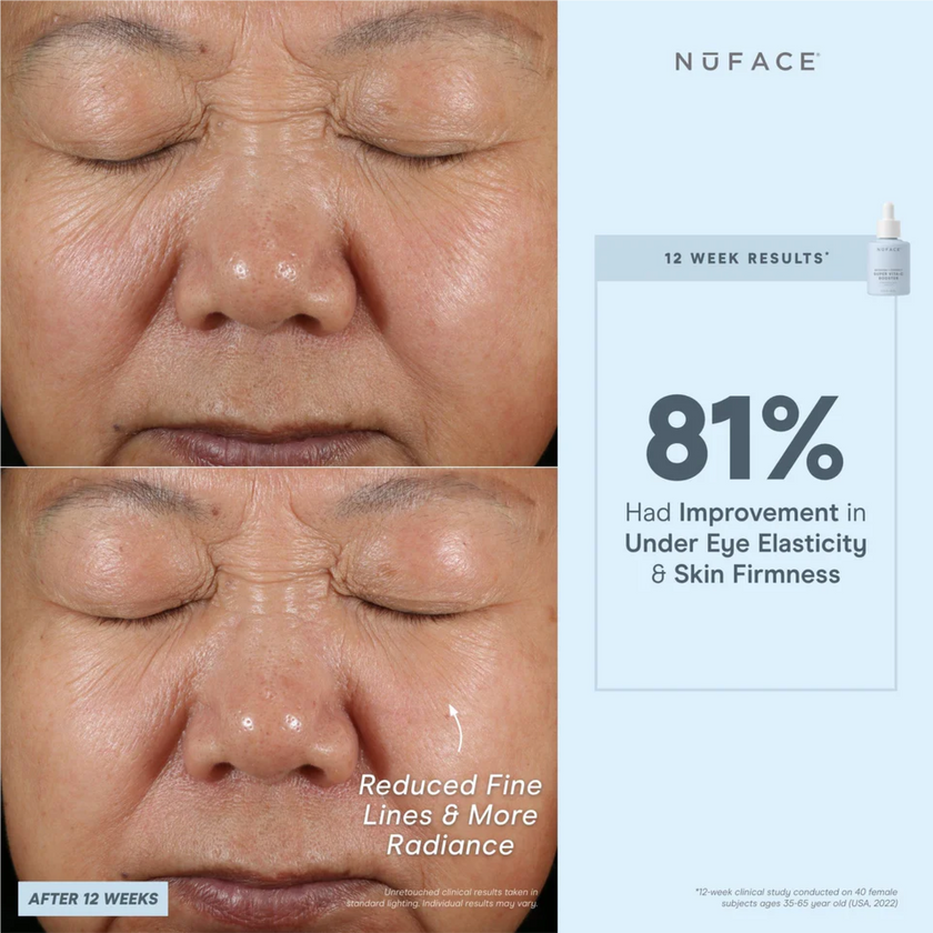 NuFACE Super Vita-C Booster Serum