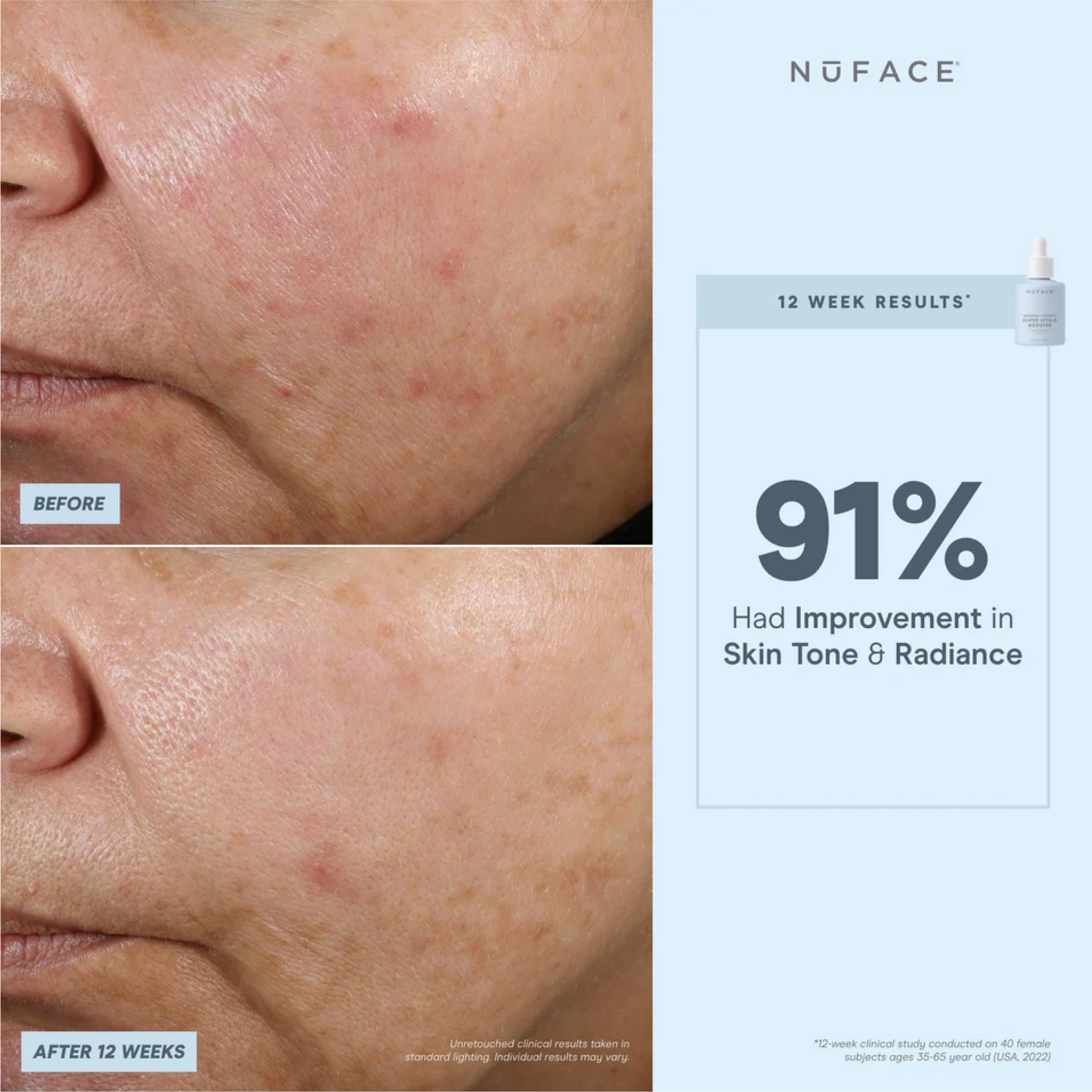 NuFACE Super Vita-C Booster Serum 5mL