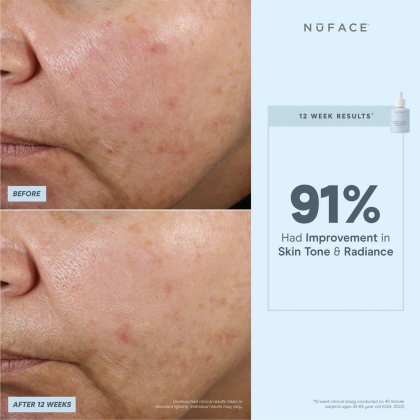 NuFACE Super Vita-C Booster Serum 5mL